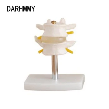 Модел DARHMMY за лумбалния отдел на гръбначния стълб (раздел 2)