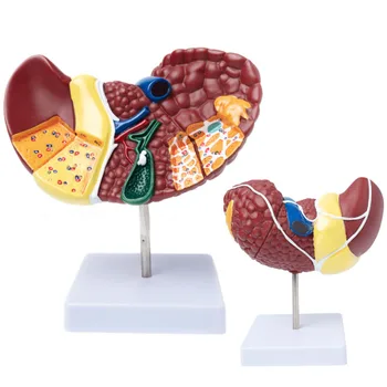 Анатомическая модел патологична черния дроб на човека 1: 1 Показване на модели за обучение по анатомия на храносмилателната система